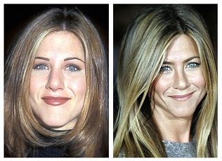 Things look a lot fancier and grand when seen from far, far away. Jennifer Aniston Plastic Surgery Before and After Nose Job ...