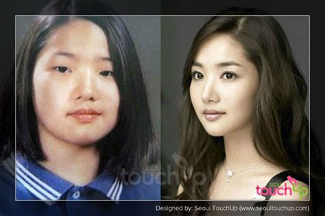 She just wanted to be an actress, not a star. How A Burglar Used Korean Plastic Surgery For His ...