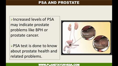 How To Reduce Psa Levels Naturally Planet Ayurveda Youtube