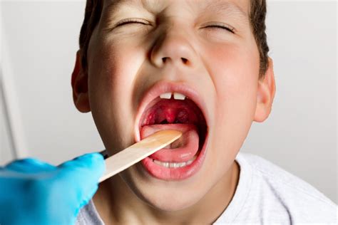 Tonsillectomy And Adenoidectomy In Toddlers