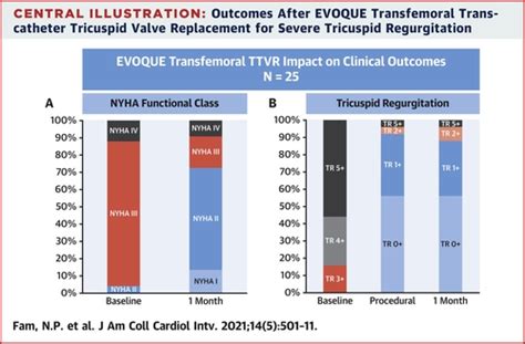Transfemoral Transcatheter Tricuspid Valve Replacement With The Evoque