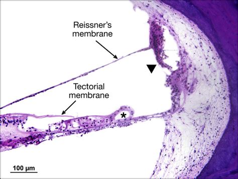 Reissners Membrane