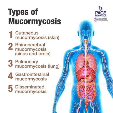 Black Fungus Infection Mucormycosis Disease Symptoms And Treatment