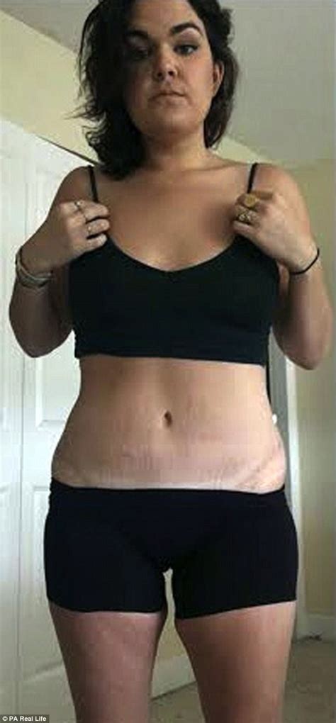 Mcdonalds Addict Sheds 170lbs To Get The Body Of Her Dreams Daily Mail Online