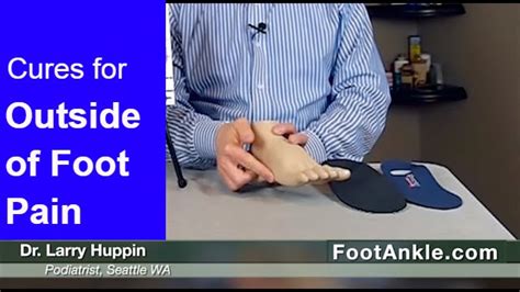 How To Treat Pain On The Outside Of The Foot With Seattle Podiatrist Dr