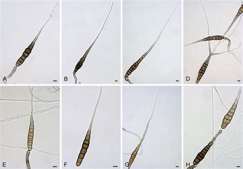 This photomicrograph shows a chain of conidia of a alternaria sp. Alternaria grandis: conidia and conidiophores. A-D. CBS ...