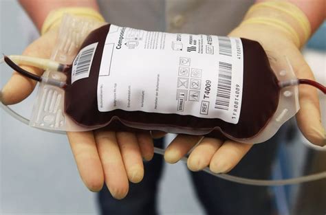Your Blood Is Actually Never Blue — Heres Why Its Always Red