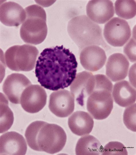 Basophilic Granulocyte In Peripheral Blood Smear Human Eccles
