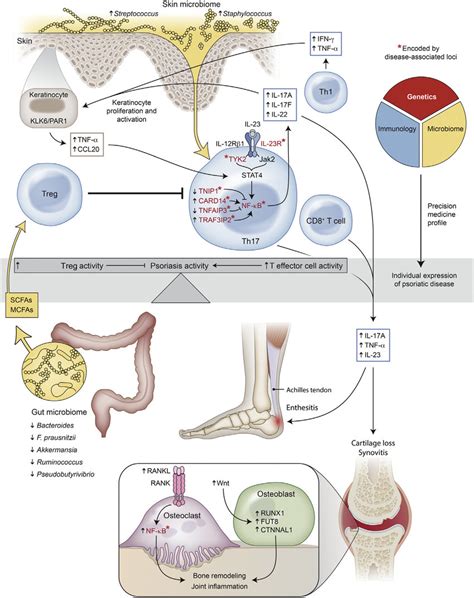 The Multifactorial Pathogenesis Of Psoriatic Disease The Development