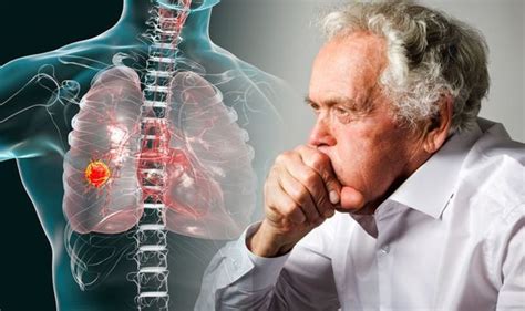 Lung Cancer A Smokers Cough Could Put You At Higher Risk Of The
