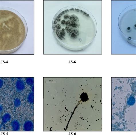 Macroscopic A And Microscopic B Features Of Fungal Isolates