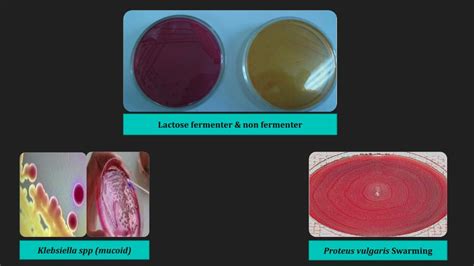Ppt Isolation And Identification Of Enterobacteriaceae And Pseudomonas