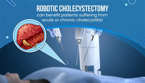 Robotic Cholecystectomy Can Benefit Patients Suffering From Acute Or