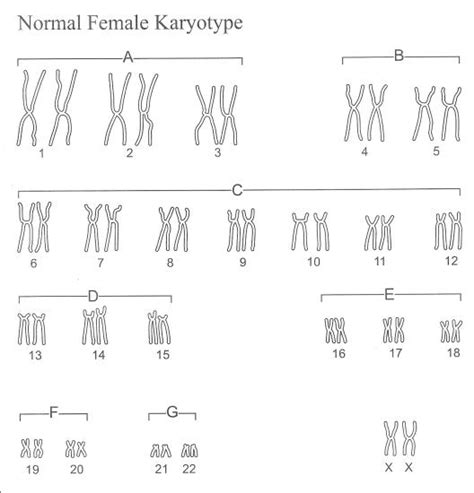12 Karyotype Worksheet Answers Biology Worksheeto