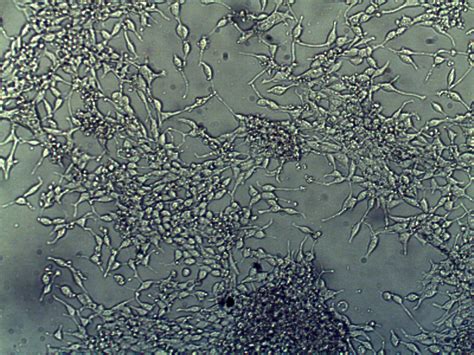 Do cells grow in size. What can I do to make LNCaP cells grow in a monolayer ...