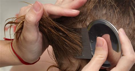Quick And Easy Ways To Get Rid Of Lice Using What You Already Have In