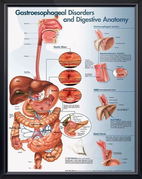 Gastroesophageal Disorders Anatomy Poster For Medical Office And Classroom Gastroenterology