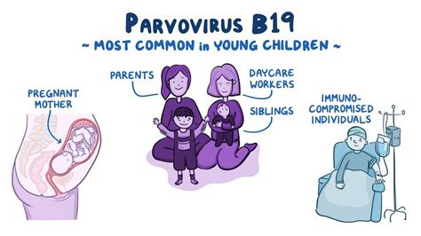 Parvovirus B19 Osmosis