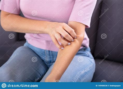 Woman Scratching The Itch On Her Arm Stock Photo Image Of Home Lady