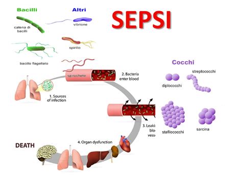 It can also cause sepsis. Sepsi - Download Wallpapers Sepsi Osk 4k Logo Geotmeric ...