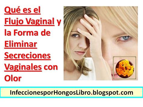 Qué Es El Flujo Vaginal Y La Forma De Eliminar Secreciones Vajinales Con Olor Infecciones Por