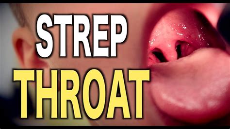 how long does a strep throat last things you need to know scoopify