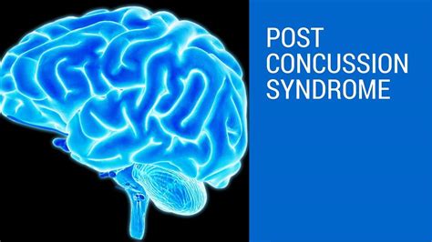 Post Concussion Syndrome Causes Symptoms Recovery Treatment