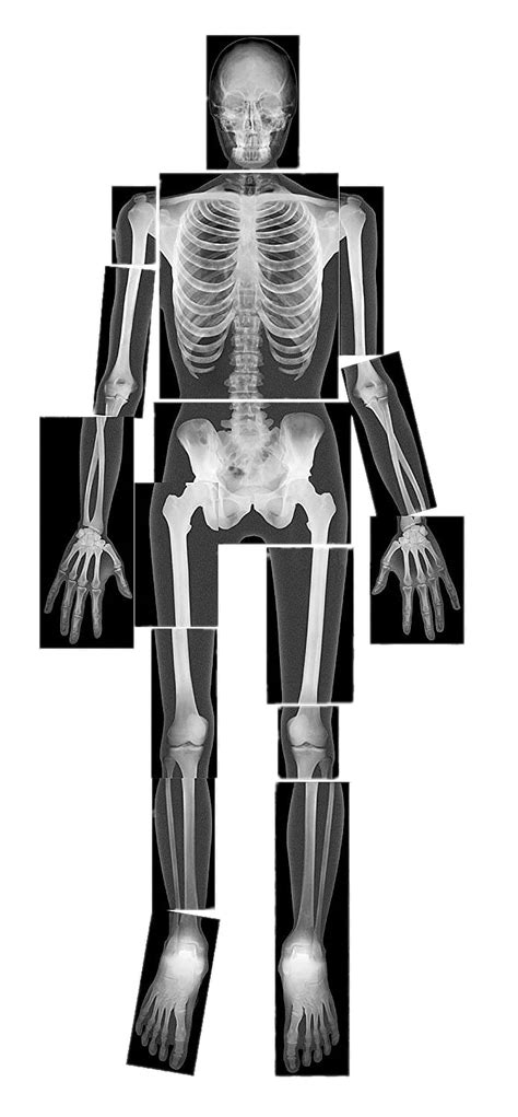 X Ray Of Body