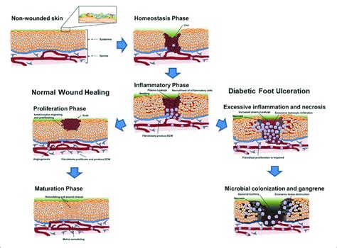 Schematic Overview Of The Evolution Of A Skin Lesion Toward A Regular