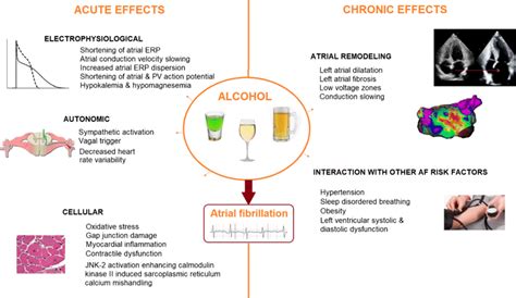 Relationship Between Acute And Chronic Alcohol Intake And Atrial