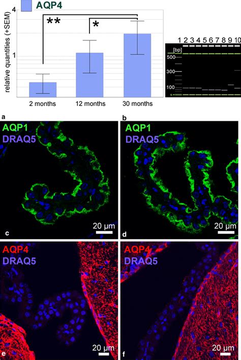 Aqp4 Expression In The Mouse Choroid Plexus From Different Age Groups