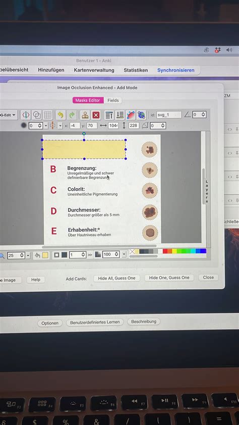 How do I suggest an image occlusion card? - 🙋 Support - AnkiHub Community