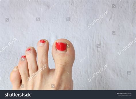 Feet Toes Poor Conditionin Need Pedicurefeet Stock Photo 1406079599