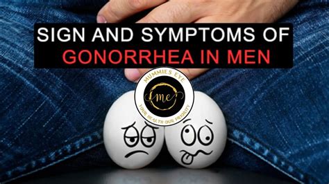 Sign And Symptoms Of Gonorrhea In Men Youtube