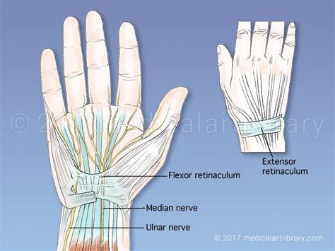 Carpal Tunnel Medical Art Library