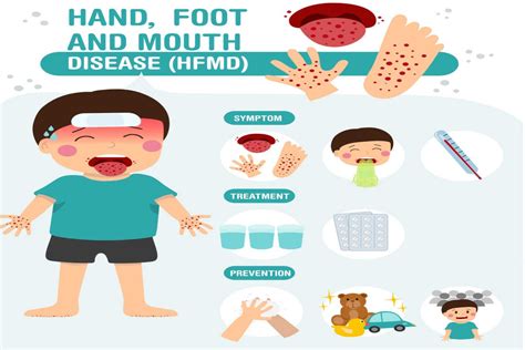 Handfoot And Mouth Disease Hfmd In Babies Home Remedies