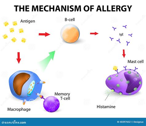 Mechanism Of Allergy Stock Vector Illustration Of Immunology 40397652