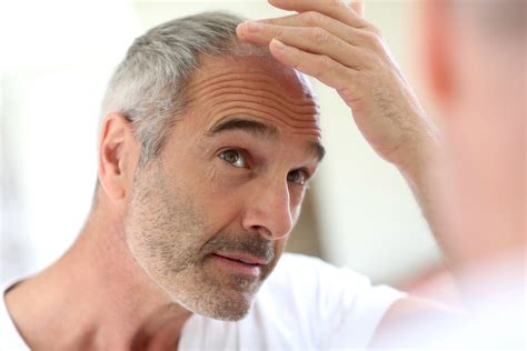 Researchers May Have Found A Miracle Cure For Baldness Bgr