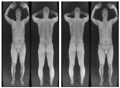 Airports With Naked Body Scanners