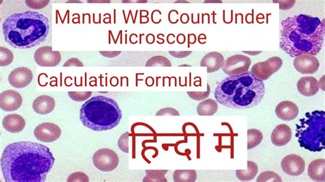 Wbc Count Under Microscope Wbc Count Procedure Wbc Count Formula