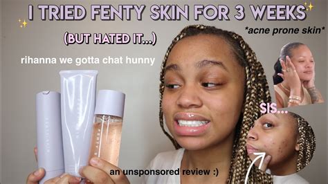 I Tried Fenty Skin For 3 Weeks Acne Prone Skin Rihanna We Gotta Chat