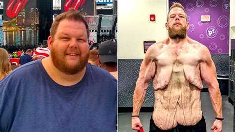 Man Who Lost 160kg In Stunning Body Transformation Reveals Unexpected Side Effect Dmarge