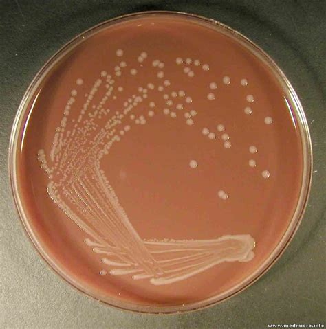 Food Science Chocolate Agar Plate Microbiology Agar Gram Negative