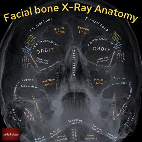 Facial Bone X Ray Anatomy Ap By Dr Naveen Sharma Grepmed