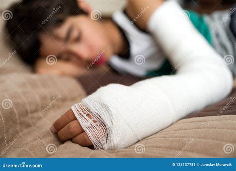 Broken Hand In Cast Stock Image Image Of Plaster Hurt 123137781