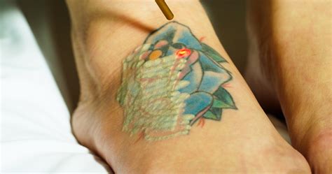 The best laser tattoo removal in houston tx. Eraser Clinic Brings Multi-Wavelength Astanza Trinity ...