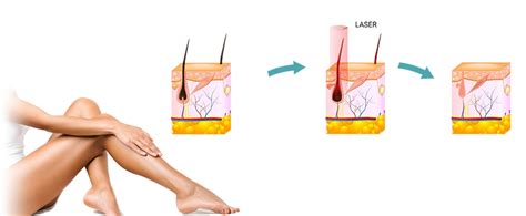 Laser hair removal delhi 188 write a comment. Full Body Laser Hair Removal in Delhi, India at Low Cost ...