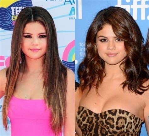 Selena Gomez Plastic Surgery For Older Looks