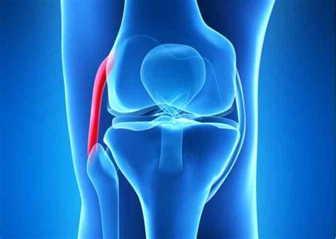 Lcl Surgery Fibular Collateral Ligament Reconstruction Knee Specialist Minnesota