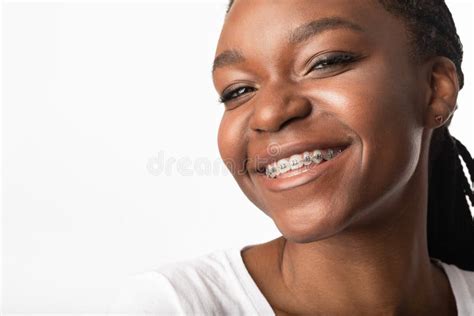 Portrait Of Girl In Braces Smiling To Camera Studio Shot Stock Image